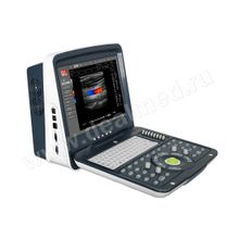 Портативный УЗИ сканер с цветным допплером AcuVista RS880i Китай