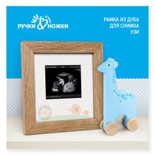 Ручки&Ножки для снимка УЗИ