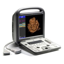 Ультразвуковой сканер S8Exp