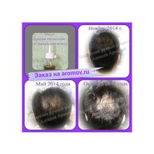 Масло от интенсивного выпадения волос (облысения)