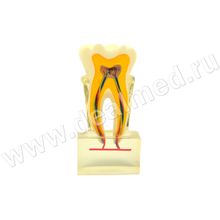 Анатомическая модель зуба в разрезе